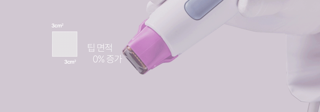 팁 면적 33% 증가로 빨라진 시술 속도