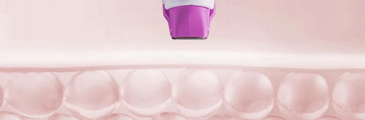 자동 조절 알고리즘 기술