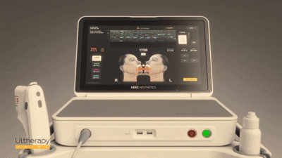 커진 모니터로 시술 정확도 UP