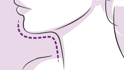 NO 스테로이드, FDA 승인