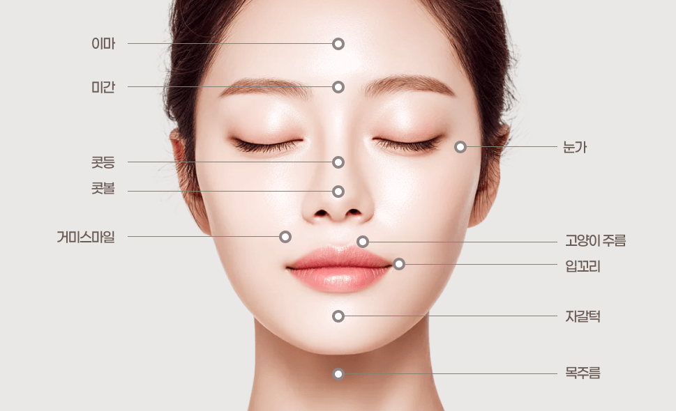 주름 보톡스 시술부위