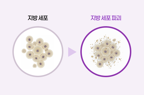 지방세포 파괴 (Adipocytolysis)