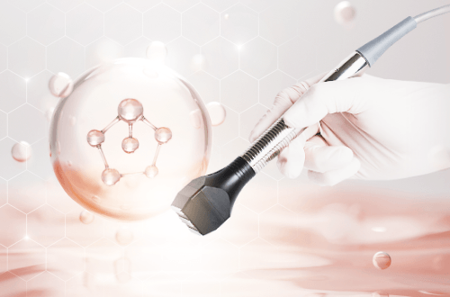 콜라겐 리모델링으로 V라인 효과