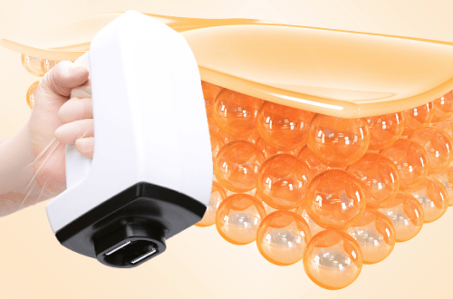 지방세포를 파괴하는 새로운 리프팅